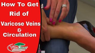 How to Get Rid of Varicose Veins amp Circulation  VitaLife Show Ep 159 [upl. by Rossing364]