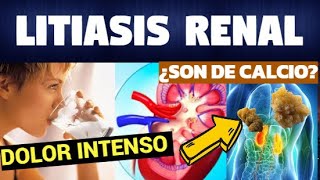 TODO SOBRE LITIASIS RENAL Síntomas Diagnostico y Tratamiento [upl. by Anelas]