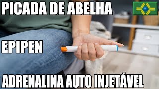 Como Agir Diante de Uma Picada de Abelha [upl. by Havens92]