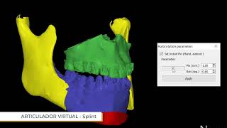 Virtual Articulator Analyze dental occlusion [upl. by Light306]