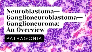 NeuroblastomaGanglioneuroblastomaGanglioneuroma Overview pathagonia endocrine pathology [upl. by Gosney]