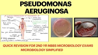 Pseudomonas aeruginosa  Pseudomonas infection  pseudomonas lab diagnosis  microbiology  MBBS [upl. by Damarra]