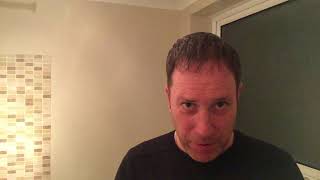 1 year hair transplant update [upl. by Joseph]