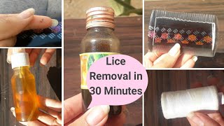 Lice Removal Treatment At home  Lice eggs Nits lice remedy Remove lice from head  Glow Yourself [upl. by Llerrit644]