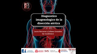 Diagnóstico imagenológico de la disección aórtica [upl. by Esereht]