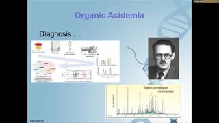 Organic Acidemia Overview and clinical presentation Dr Maha Alotaibi [upl. by Keiko]