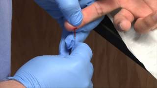 Phlebotomy Dermal Capillary Punctures  Blood Collection RxTN [upl. by Dnomyad]