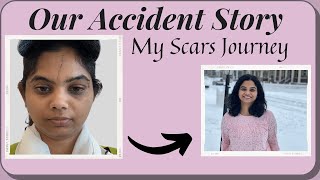 Our Accident Story  Other Side of our Hawaii Travel  TeluguVlogsUSA  My Facial scars [upl. by Birdt836]