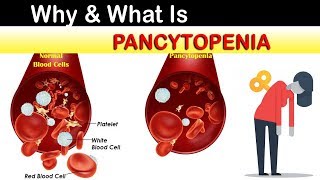 Why amp What Is Pancytopenia [upl. by Venus888]