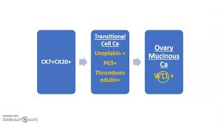 Approach to metastatic Carcinoma of unknown primary [upl. by Nnilsia]