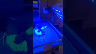 phototherapy apgar newbornbaby neonate newborn newborncare jaundicetreatment jaundice [upl. by Lucey620]