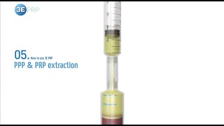 3E PRP  Plateletrich plasma extraction guide [upl. by Yecal]