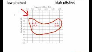 How to Read an Audiogram  Watch this Video Before You Buy Hearing Aids [upl. by Mason]