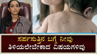 Herpes Zoster Symptoms amp Treatment  Shingles  Vijay Karnataka [upl. by Alecram292]