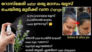 Rosemary water use ചെയ്ത് ഞെട്ടിക്കുന്ന റിസൾട്ട്‌😱 hair smoothening പണി തന്നു 😭with proof [upl. by Nimrak]