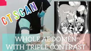 CT Scan of the Whole Abdomen with Triple Contrast Oral Rectal amp IV with a twist  Radiology [upl. by August]