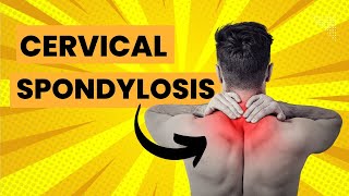 Cervical Spondylosis Exercises amp Stretches for Neck Pain amp Arthritis [upl. by Aeslehs]