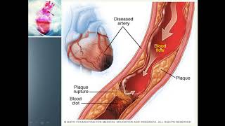 Ischemia  Myocardial Ischemia amp Its causes [upl. by Yasibit]