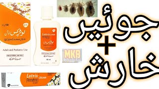 The SHOCKING Truth About Lotrix Lotion Urdu [upl. by Akemal]