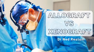 Interview with Dr Ned Restom  Allograft vs Xenograft [upl. by Anircam]