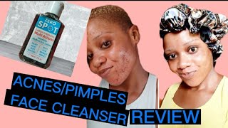 Acnes pimples face cleanser reviews 09044378368 [upl. by Asta]