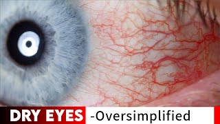 How to Keep Your Eyes Healthy  Dr Hansaji Yogendra [upl. by Ber]