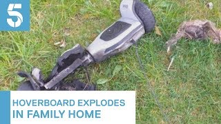 Family issue fire warning as hoverboard explodes in their home  5 News [upl. by Floyd]