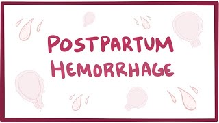 Postpartum hemorrhage  causes symptoms diagnosis treatment pathology [upl. by Aissyla182]