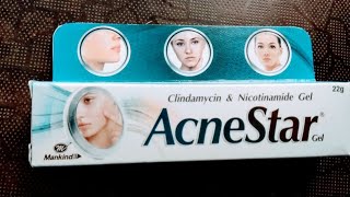 Acnestar Soap Vs benzoyl peroxide cream  Acnestar Soap review [upl. by Materi]