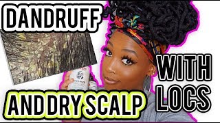 HOW TO GET RID OF DANDRUFFDRY SCALP WITH LOCS [upl. by Vani389]