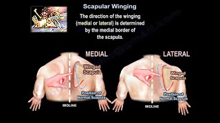 Scapular Winging  Everything You Need To Know  Dr Nabil Ebraheim [upl. by Ennayr444]