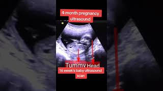 Fetal Heart beat monitoring on ultrasound baby ultrasound abdomen pregnant [upl. by Leilah542]