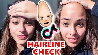 HAIRLINE CHECK on TikTok has me ScReaMiNG AGAIN🤦‍♂️😲🥚 [upl. by Bollinger]