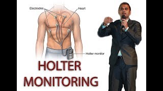 HOLTER MONITORING [upl. by Nivalc287]