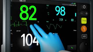 Mindray BeneHeart D60 Defibrillator Monitor  Expand Rescue Potential [upl. by Dnilazor999]