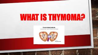 What is Thymoma  What causes thymoma  Thymoma symptoms  Thymoma treatment [upl. by Aleel]