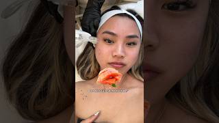 GETTING A CONTROVERSIAL FACIAL 😱😳🧬🧖🏻‍♀️rejuran [upl. by Aland57]