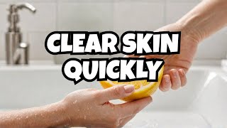 Remove Dark Spots FAST with THIS Home Remedy  No More Spots [upl. by Nudd316]