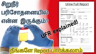 சிறுநீர்ப்பரிசோதனைUrine Full Report in Tamilkidney pain location on body in tamilkidney failure [upl. by Rose]