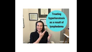 Treating HYPERKERATOSIS from lymphatic disease [upl. by Perice]