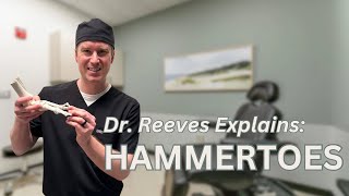 Hammertoes Causes Symptoms Treatments [upl. by Kliber]