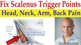 Fix Scalenus Trigger Points Quick Relief to Head Neck Arm Upper Back Pain  Dr Alan Mandell DC [upl. by Nycila618]