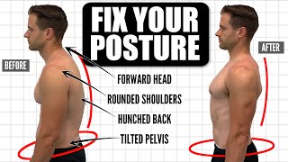 How To FIX Your Posture  10Minute Daily Routine [upl. by Hester617]