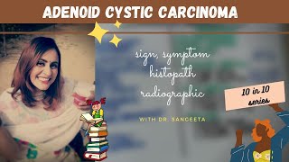 adenoid cystic carcinoma [upl. by Pirali676]