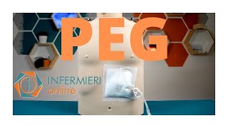 PEG  GESTIONE E MEDICAZIONE Gastrostomia Endoscopica Percutanea  LA NUTRIZIONE ENTERALE [upl. by Bernete619]