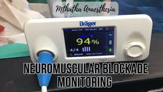 Neuromuscular Blockade Agent Monitoring [upl. by Adnirim158]