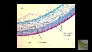 ORGANISM SLIDE Peziza [upl. by Canfield]