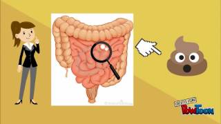 Ciclo de vida de strongyloides stercoralis [upl. by Timofei]