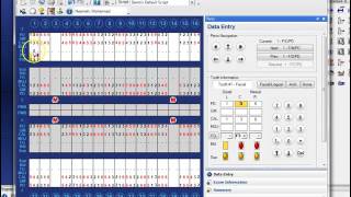 Dentrix step by step  Perio charting [upl. by Sharron137]