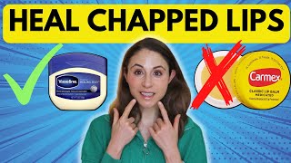 10 TIPS TO HEAL CHAPPED LIPS FAST 👄 Dermatologist DrDrayzday [upl. by Lavinia]